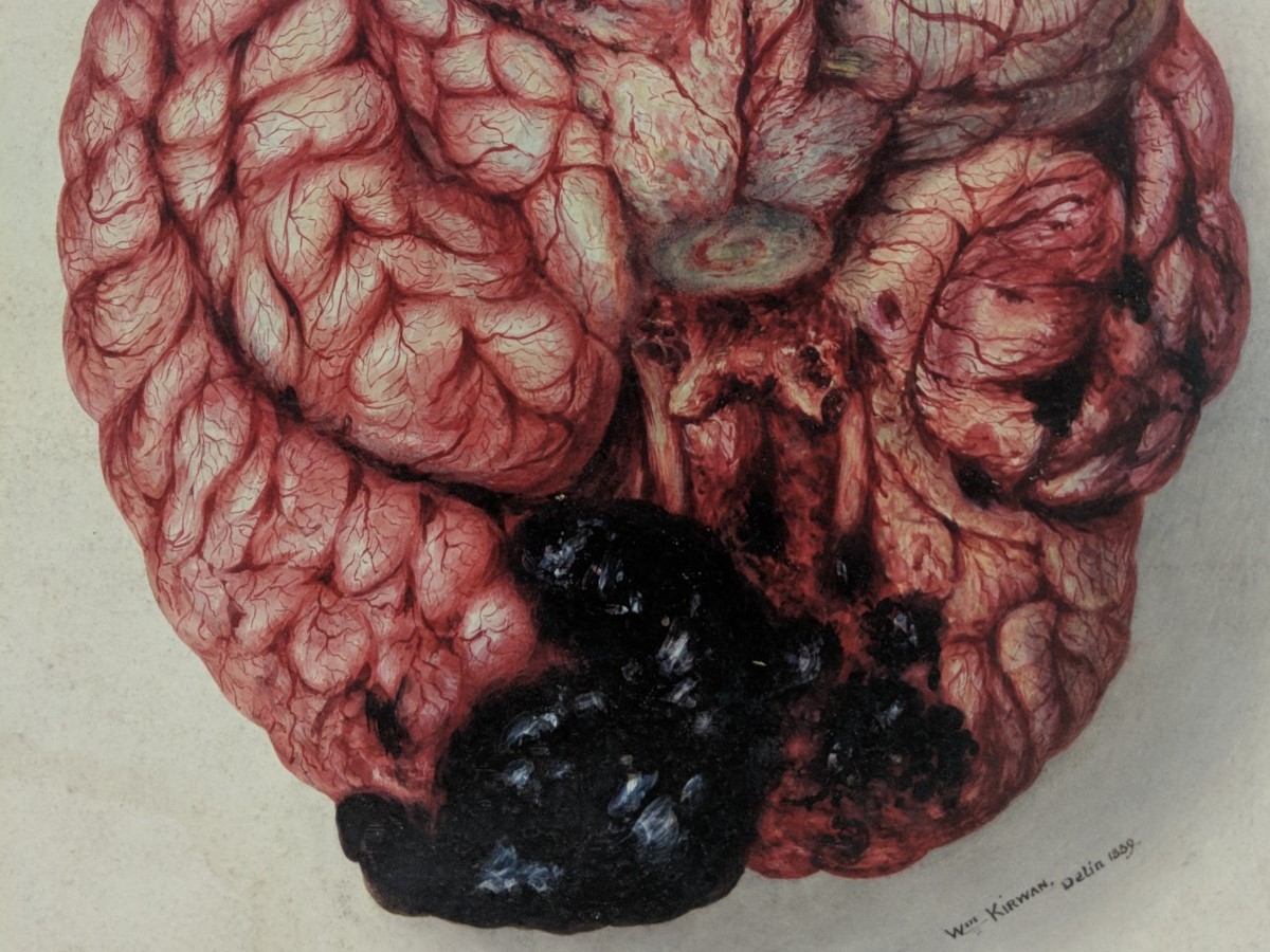 Watercolour illustration of a brain
